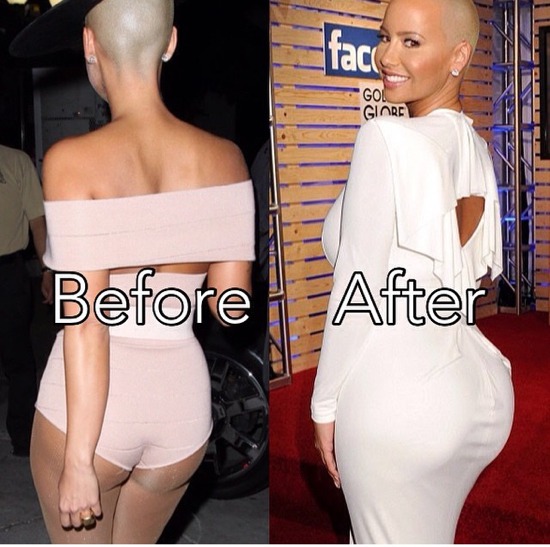 amber-rose-butt-implants