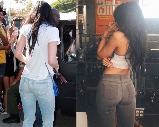 kylie-jenner-butt-implants