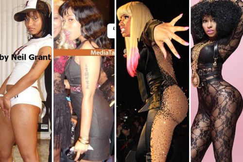 nicki-minaj-butt-implants