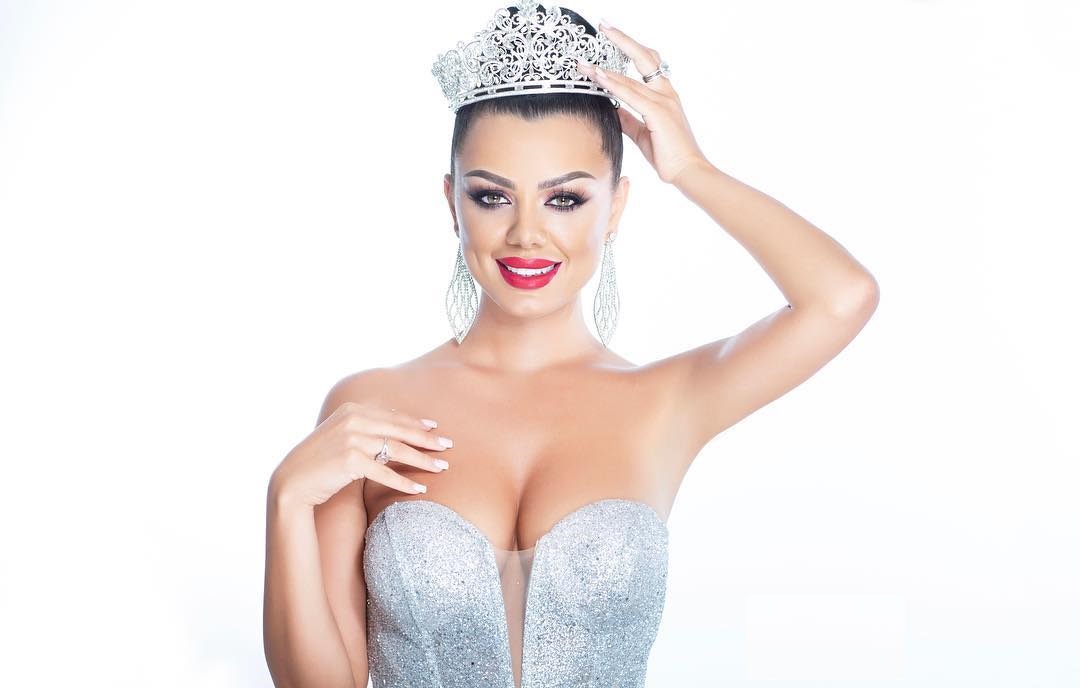Miss Kosova “bllokohet” kur e pyesin për vendlindjen. Video bëhet virale