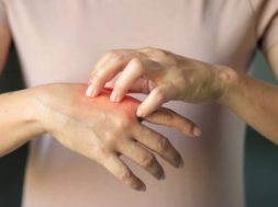 Healthcare and medical concept. Female scratching the itch on her hand, cause of itching from Allergy, chemical, allergic to detergent or dishwashing liquid and dermatitis, insect bites, burned, drug, skin diseases. Health problem.