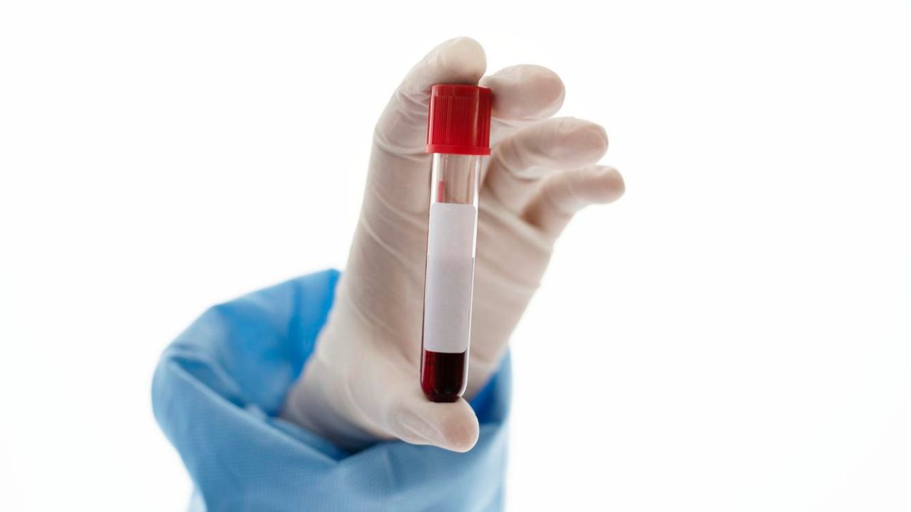 Neurokirurgu thotë se një analizë e thjeshtë gjaku mund të parashikojë sëmundjet e trurit vite para simptomave